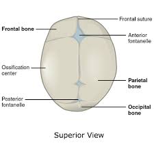 The squamous suture is located on the lateral skull. Coronal Suture Radiology Reference Article Radiopaedia Org