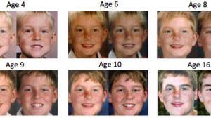 (cette forme est parfois appelée triangle pointant vers le haut.) pour réduire la largeur apparente du haut du visage, choisissez des formes de montures plus larges à la base. A Quoi Ressembleront Vos Enfants Dans 20 Ou 30 Ans