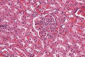 The lysosome is commonly referred to as the cell's recycling center because it processes unwanted material into substances that the cell can use. File Niemann Pick Disease Jpg Wikimedia Commons