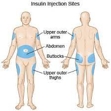 Some people may have very thin abdominal areas, though. How To Give An Insulin Injection What You Need To Know