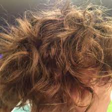 However, the pharmakinetics of coq10 in the inner ear is not yet clarif … From Total Hair Loss To A Head Of Curls Healthful Elements