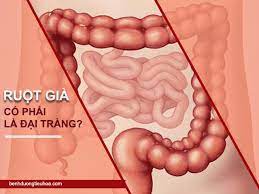 Trực tràng là đoạn cuối của ruột già và là một đoạn ruột thẳng. Ruá»™t Gia Co Pháº£i Ä'áº¡i Trang Khong Chá»©c NÄƒng Cá»§a No La Gi