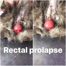 Image result for Rectal prolapse