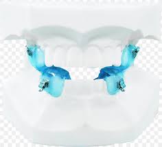 € 142 50% off € 71 vat will be charged at customs clearance. Jaw Orthodontics Dental Braces Twin Block Appliance Therapy Png 1421x1284px Jaw Aqua Blue Body Jewelry Clinic