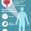 Bladder cancer may be associated with cancers of the kidneys, ureters, or urethra. 1