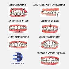 מרפאות מומחים ויישור שיניים פרופ' עיני - ראש העין