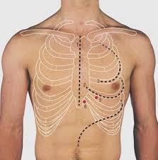 The thorax or chest is a part of the anatomy of humans, mammals, other tetrapod animals located between the neck and the abdomen. Thorax Surface Anatomy 4 Edition