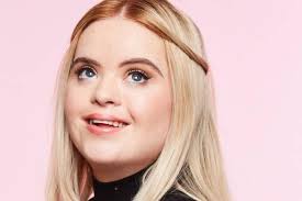 NI model with Down's Syndrome 'paving the way for others with disabilities'