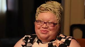 Check spelling or type a new query. Black Albino Designer Lives Out Loud In Color