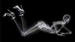 These racy X-ray images of pinup models aren't what they seem | Mashable