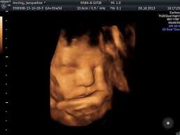 $15 coupon towards any future hd ultrasound packages purchased during the same pregnancy; 3d 4d Scanning At 35 Weeks