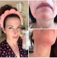 Has anyone tried Liv Schmidt's Skinni Societe? Any lasting success with it? 