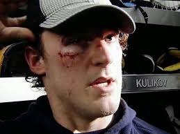 Video Of Day: Jake McCabe hit