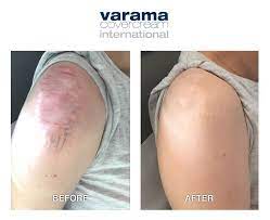Pin On Skin Conditions