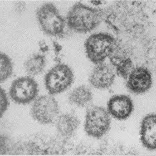 Ebola virus disease (evd) is a rare and deadly disease in people and nonhuman primates. Febre Hemorragica Saiba O Que E E Quais Os Sintomas Do Arenavirus 21 01 2020 Uol Vivabem