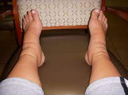Pregnant Socks Best Pregnancy Socks To Stop Swelling