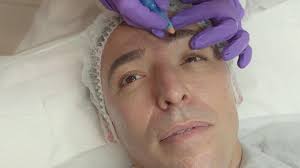 I Tried Microblading to Get Hollywood Eyebrows