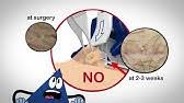 Maybe you would like to learn more about one of these? Coopersurgical S Advincula Arch Youtube