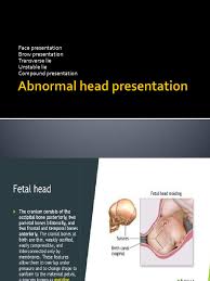 Image result for Compound Presentation