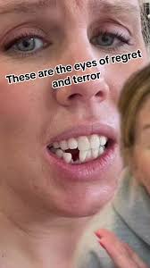 sometimes you gotta do the scary thing to get to the desired outcome!  #strugglebustocrazytown #invisalign #invisalignsmile #missingtooth  #adultbracescheck #newsmile #pulledtooth #trayday #greenscreen