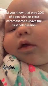 A miracle for sure! 💕