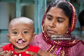 Amina and her 10 month old son, Asirul, wait to see a doctor for... News  Photo