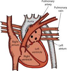 Check spelling or type a new query. Introduction To Heart And Blood Vessel Disorders In Cats Cat Owners Veterinary Manual