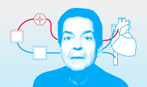 Infográfico: os 12 passos do transplante de coração como o de Faustão