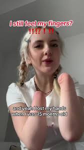 Sharon Woolridge Amputee