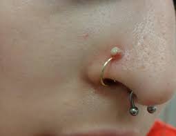 5 Steps To Treat An Infected Nose Piercing Skinnumbing