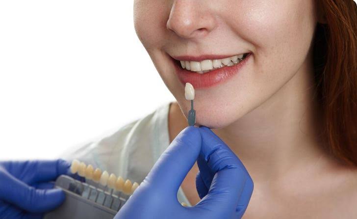 Dental Crowns product image