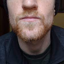 Thoughts On A Red Blond Beard Blonde Beard Beard Blonde