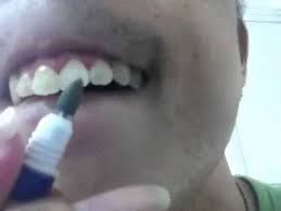 How does something as messy as charcoal whiten your teeth? How To Remove Coffee Stains From Your Teeth Inexpensively Youtube