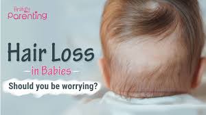 It really started to accelerate three months after i gave birth, says the chesapeake, va., mom. Hair Loss In Babies What S Normal And What S Not