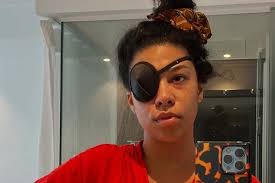 Singer worried over going blind as she's stuck in UK with famous pals amid  health issue