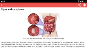 A single cell, which gets damaged or gets cancerous, keeps dividing (even when there is no need of new cells) and starts spreading the iva: Colon Cancer Amazon De Apps For Android