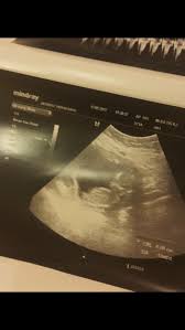 الأسبوع الرابع من الحمل هو الأسبوع الخامس للتبويض، وهكذا يصبح مدة الحمل شهر كامل. Ù†Ø¸Ø±ÙŠØ© Ø¬Ù†Ø³ Ø§Ù„Ø¬Ù†ÙŠÙ† Ø§Ù„Ø§Ø³Ø¨ÙˆØ¹ 13 Ø¹Ø§Ù„Ù… Ø­ÙˆØ§Ø¡