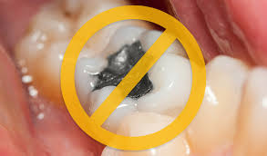 We did not find results for: Amalgamfreie Behandlung Hannover Amalgam Alternative