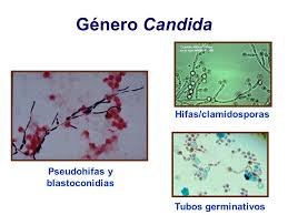 La mucormicosis es una micosis aguda causada por hongos oportunistas pertenecientes al orden de los mucorales. Hongos Productores De Micosis Profundas Ppt Descargar