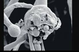 Check spelling or type a new query. Mucormycosis Or Black Fungus Infection Causes And Symptoms Medipulse Best Private Hospital In Jodhpur