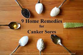 Home treatments to speed healing and help you feel better include: 9 Home Remedies For Canker Sores Tips To Avoid Canker Sore Triggers