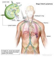 Are swollen lymph nodes painful? Hodgkin Lymphoma Vanderbilt Ingram Cancer Center