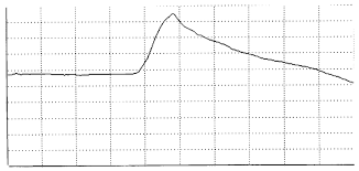 Schematic Representation Of The Y T Strip Chart Recorder