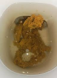 Image result for thin ribbon stools human poop