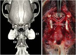 Check spelling or type a new query. Morphometric And Functional Study Of The Canine Atlantoaxial Joint Sciencedirect