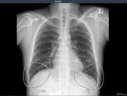 Next, a good inspiration film should show at least the 10th or 11th. Vuno Publishes Study Of Its Ai Powered Solution Improving Chest X Ray Reading Accuracy Mobihealthnews