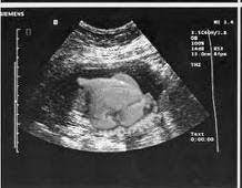 Turkey In The Oven Baby Bike Bike Quotes Ultrasound