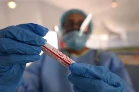 Saiba onde estão os casos confirmados. Paciente Com Variante Indiana Da Covid Passou Por Tres Cidades No Brasil Antes De Ser Notificado Veja Quais Nsc Total