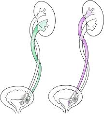 The Duplicated Collecting System Of The Urinary Tract Embryology Imaging Appearances And Clinical Considerations Springerlink
