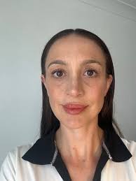 I'm Sofia and I was born with a cleft lip and palate. No one ever explained  that to me growing up. My parents didn't talk about it, not even once. “I  had